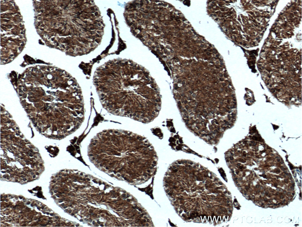 Immunohistochemistry (IHC) staining of mouse testis tissue using USP8 Polyclonal antibody (27791-1-AP)