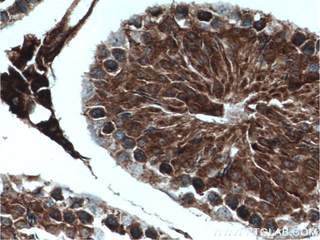 Immunohistochemistry (IHC) staining of mouse testis tissue using USP8 Polyclonal antibody (27791-1-AP)