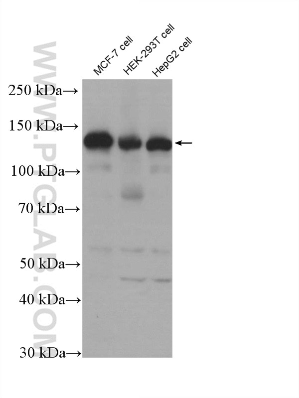 Western Blot (WB) analysis of MCF-7 cells using USP8 Polyclonal antibody (27791-1-AP)