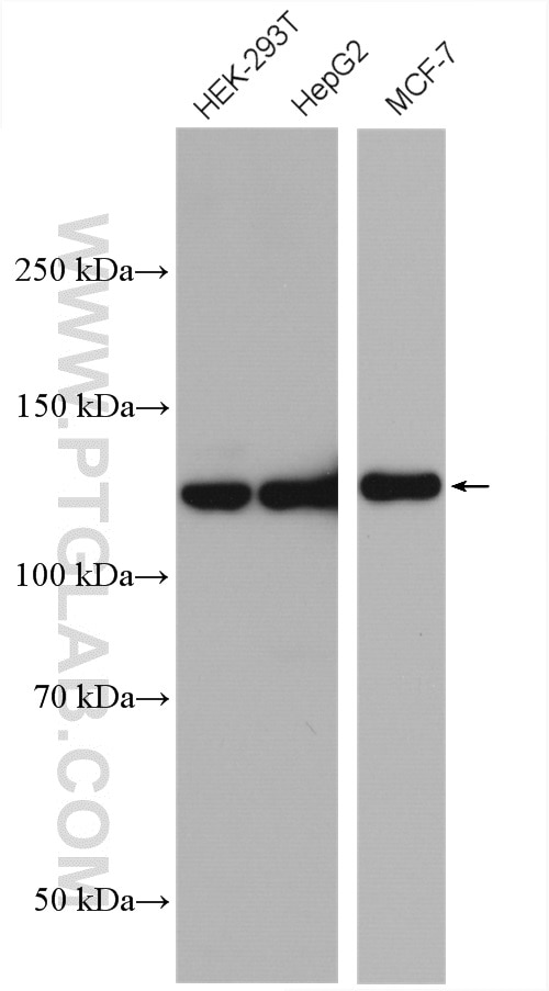 Western Blot (WB) analysis of various lysates using USP8 Polyclonal antibody (27791-1-AP)