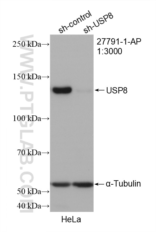 Western Blot (WB) analysis of HeLa cells using USP8 Polyclonal antibody (27791-1-AP)