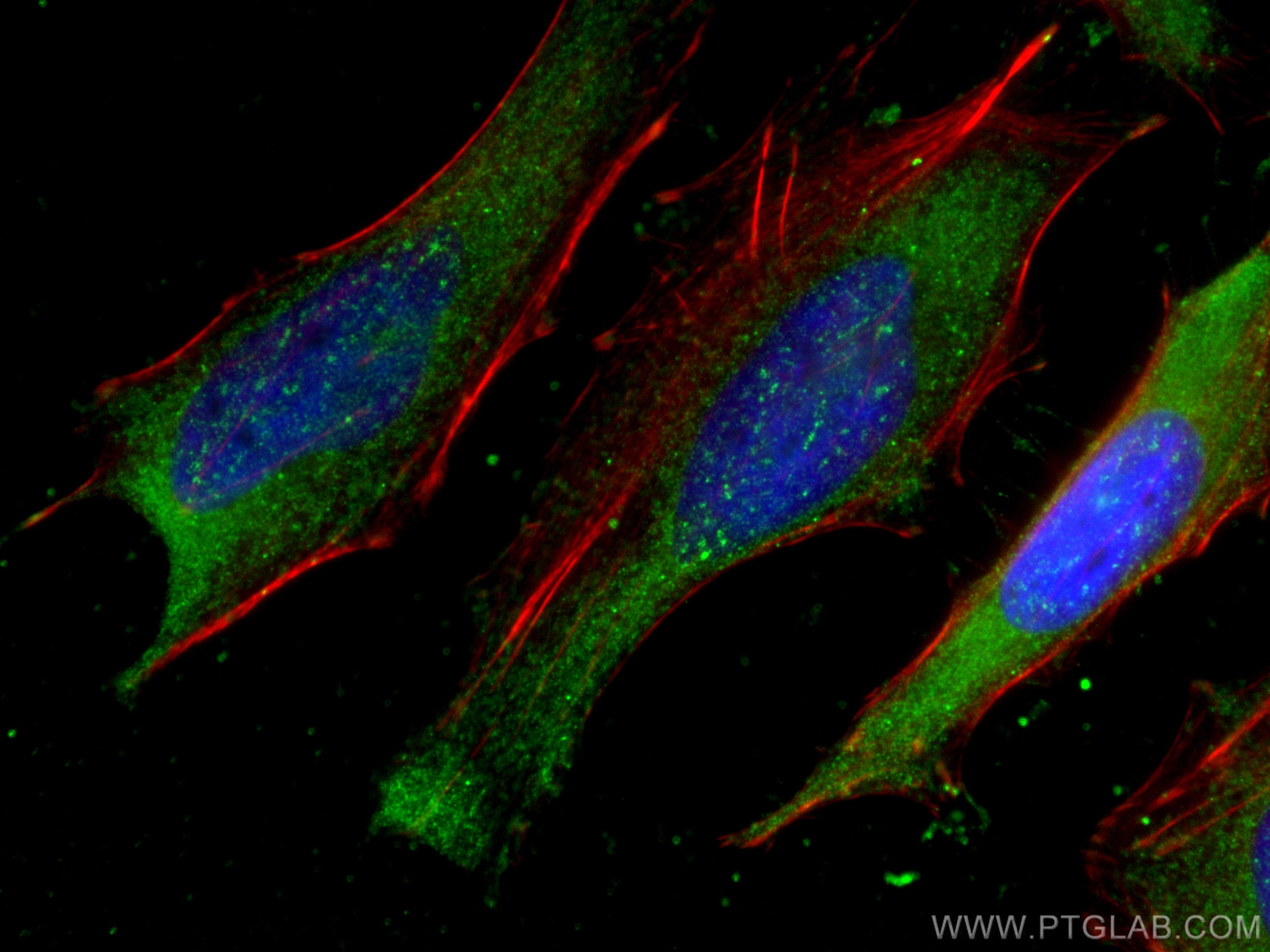 Immunofluorescence (IF) / fluorescent staining of HeLa cells using USP8 Monoclonal antibody (67321-1-Ig)