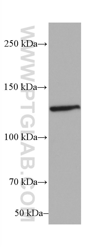 Western Blot (WB) analysis of NIH/3T3 cells using USP8 Monoclonal antibody (67321-1-Ig)