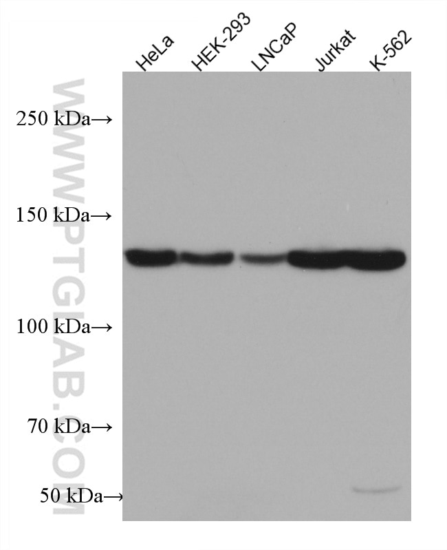 Western Blot (WB) analysis of various lysates using USP8 Monoclonal antibody (67321-1-Ig)