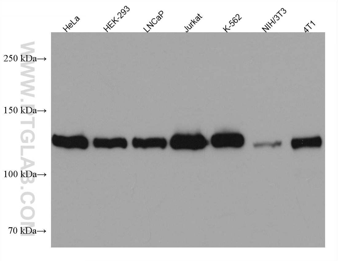 Western Blot (WB) analysis of various lysates using USP8 Monoclonal antibody (67321-1-Ig)