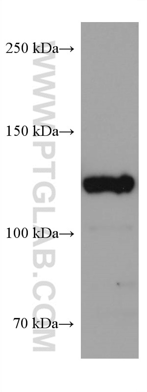 Western Blot (WB) analysis of NIH/3T3 cells using USP8 Monoclonal antibody (67321-1-Ig)