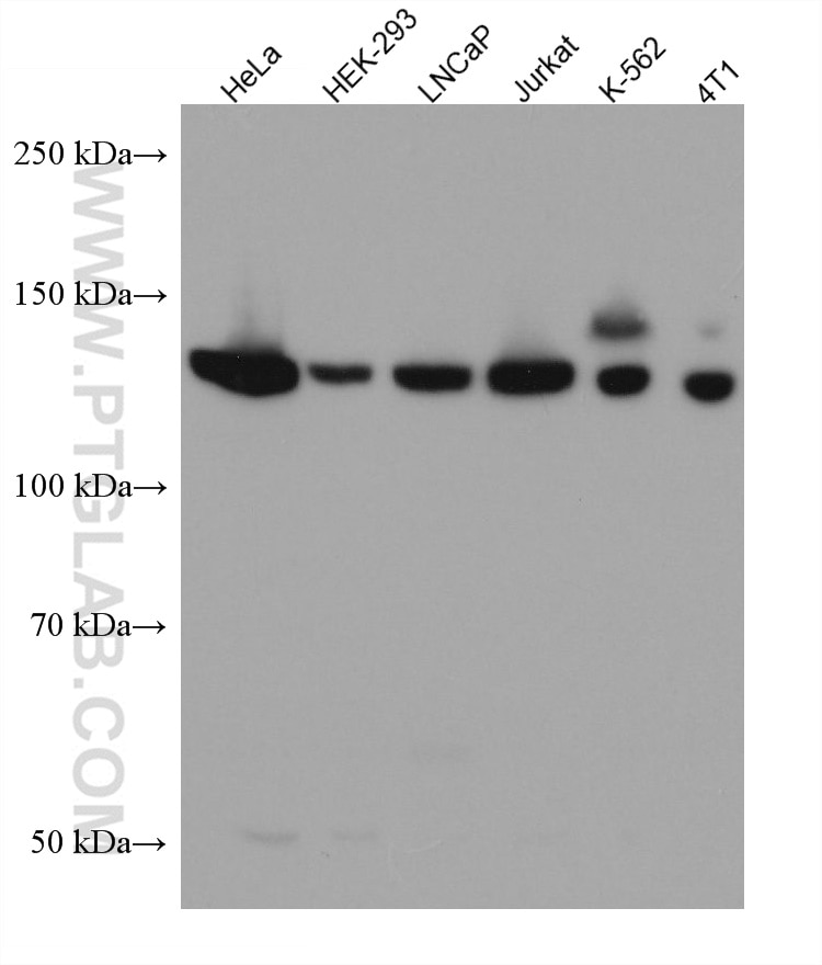 Western Blot (WB) analysis of various lysates using USP8 Monoclonal antibody (67321-1-Ig)