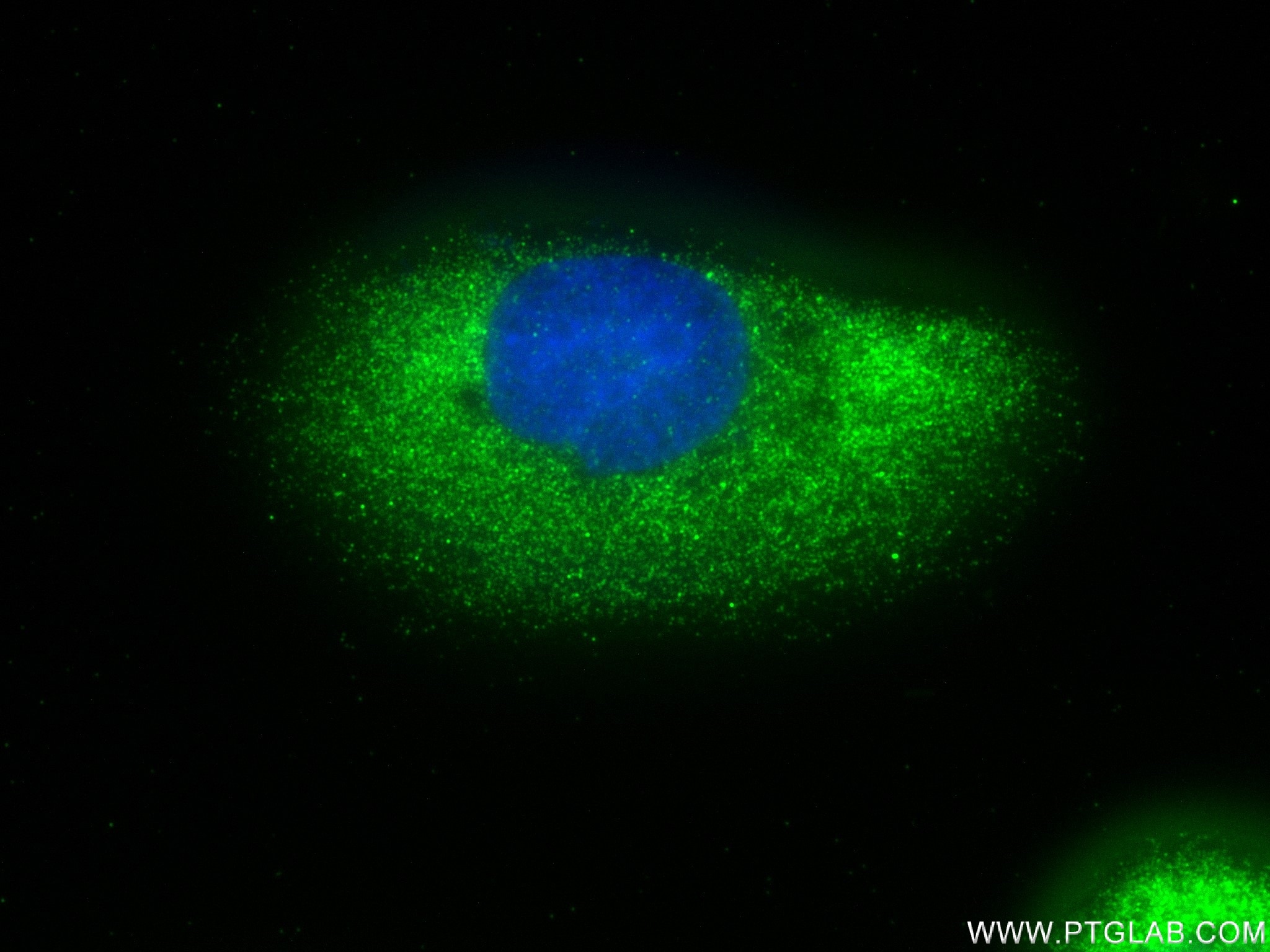 Immunofluorescence (IF) / fluorescent staining of U2OS cells using USP8 Recombinant antibody (83172-2-RR)