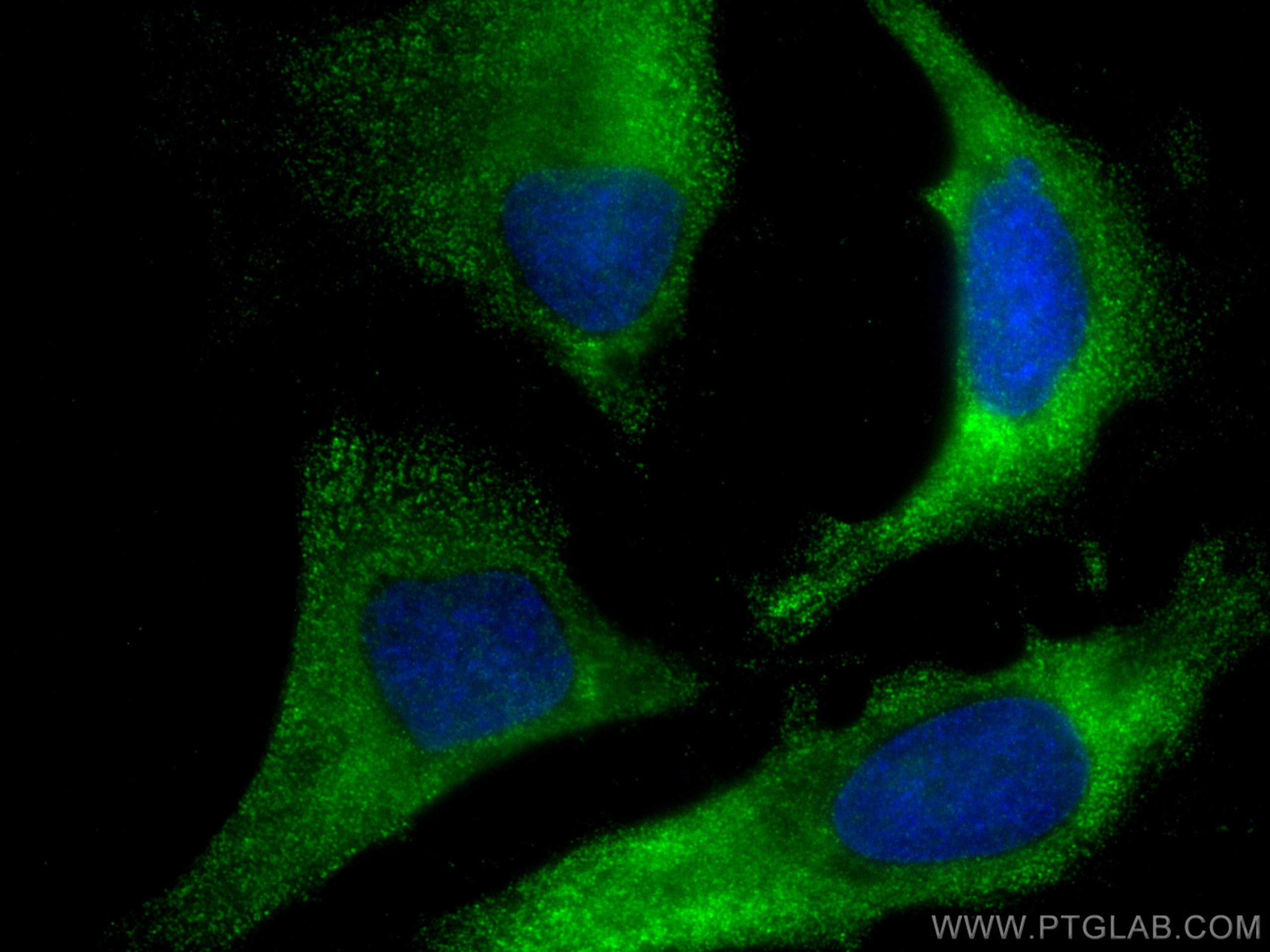 Immunofluorescence (IF) / fluorescent staining of HeLa cells using CoraLite® Plus 488-conjugated USP8 Monoclonal anti (CL488-67321)