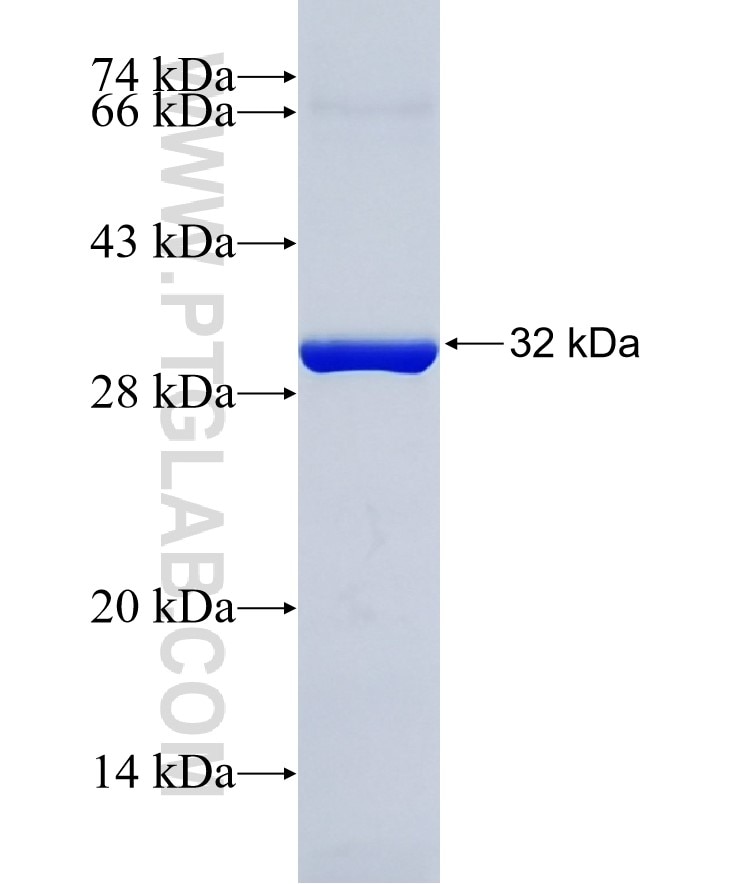 USP8 fusion protein Ag27104 SDS-PAGE
