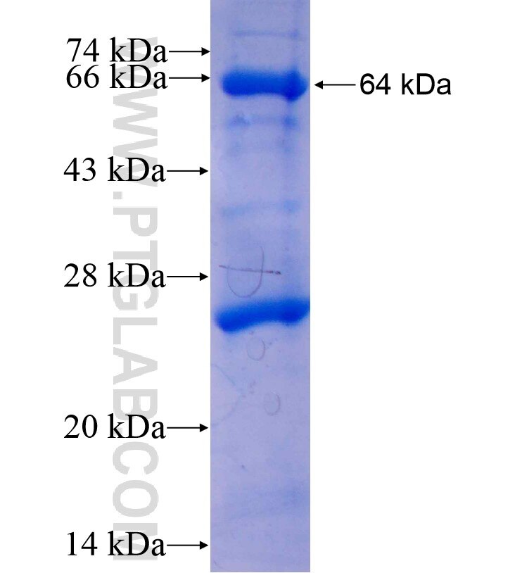 USP8 fusion protein Ag16602 SDS-PAGE