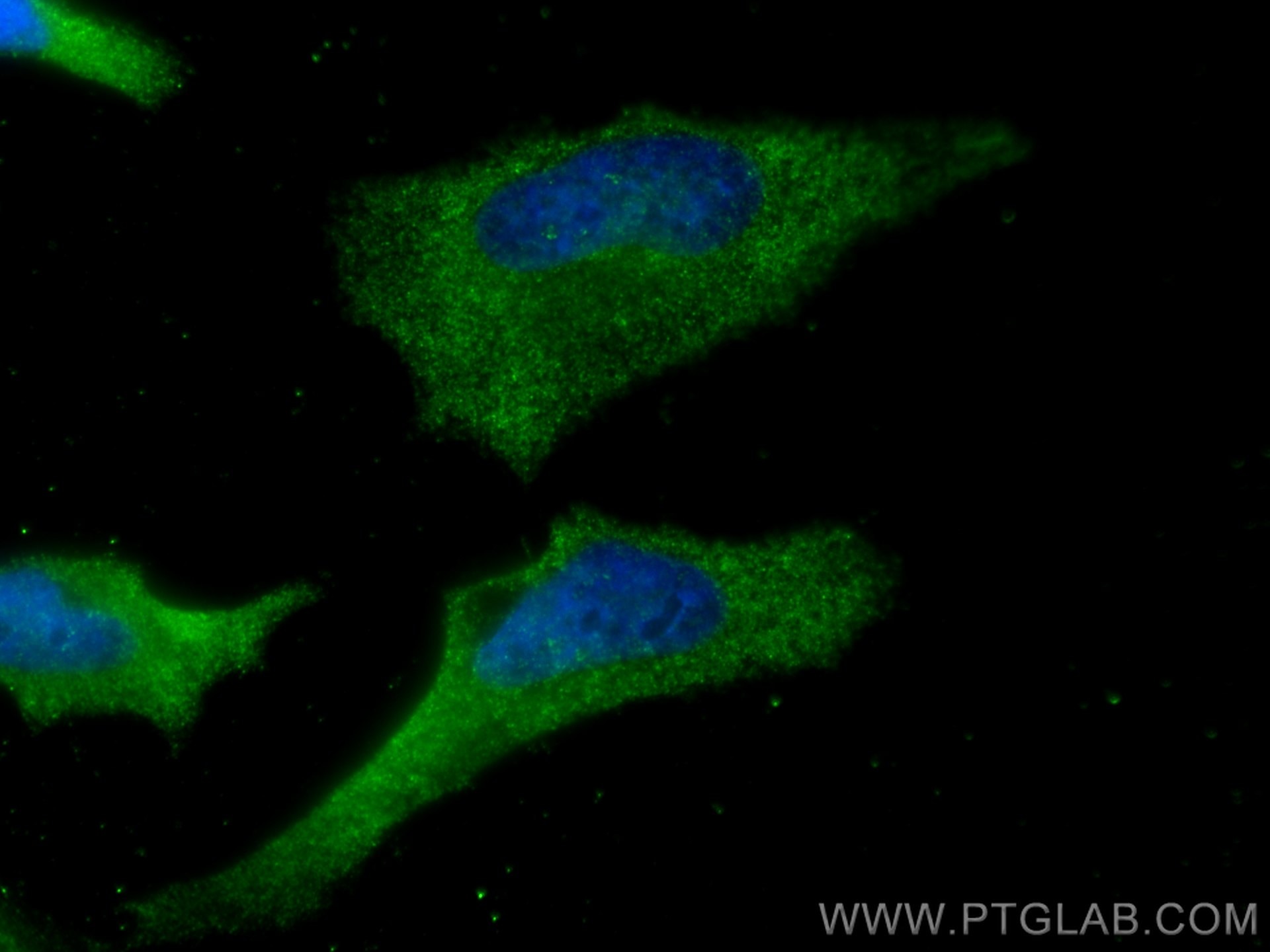 Immunofluorescence (IF) / fluorescent staining of HeLa cells using USP9X Polyclonal antibody (55054-1-AP)