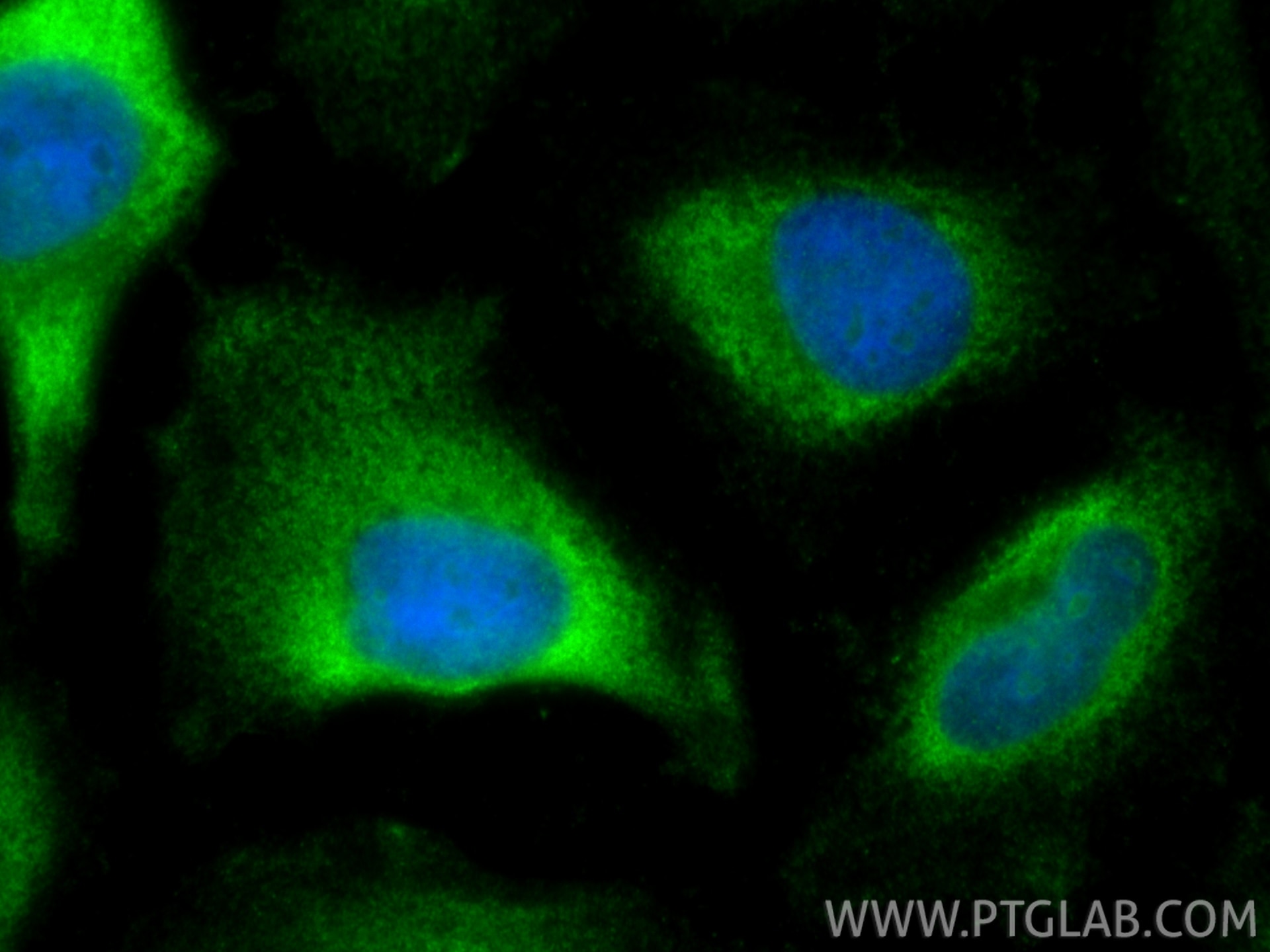 Immunofluorescent analysis of (-20°C Ethanol) fixed HeLa cells using USP9X antibody (55054-1-AP) at dilution of 1:400 and CoraLite®488-Conjugated Goat Anti-Rabbit IgG(H+L) (SA00013-2). Immunofluorescence (IF) / fluorescent staining of HeLa cells using USP9X Polyclonal antibody (55054-1-AP)