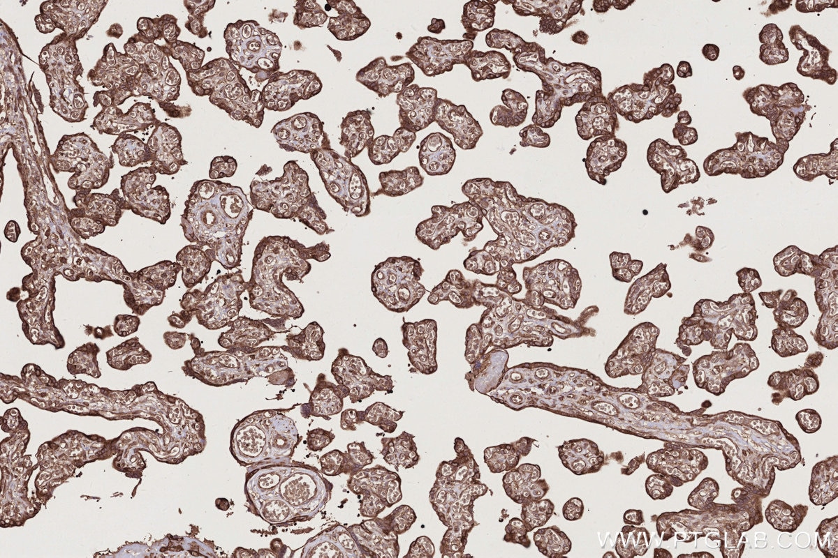 Immunohistochemical analysis of paraffin-embedded human placenta tissue slide using 55054-1-AP (USP9X antibody) at dilution of 1:1000 (under 10x lens). Heat mediated antigen retrieval with Tris-EDTA buffer (pH 9.0). Immunohistochemistry (IHC) staining of human placenta tissue using USP9X Polyclonal antibody (55054-1-AP)