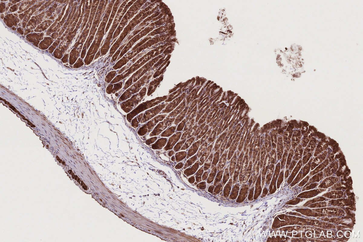 Immunohistochemistry (IHC) staining of mouse stomach tissue using USP9X Polyclonal antibody (55054-1-AP)