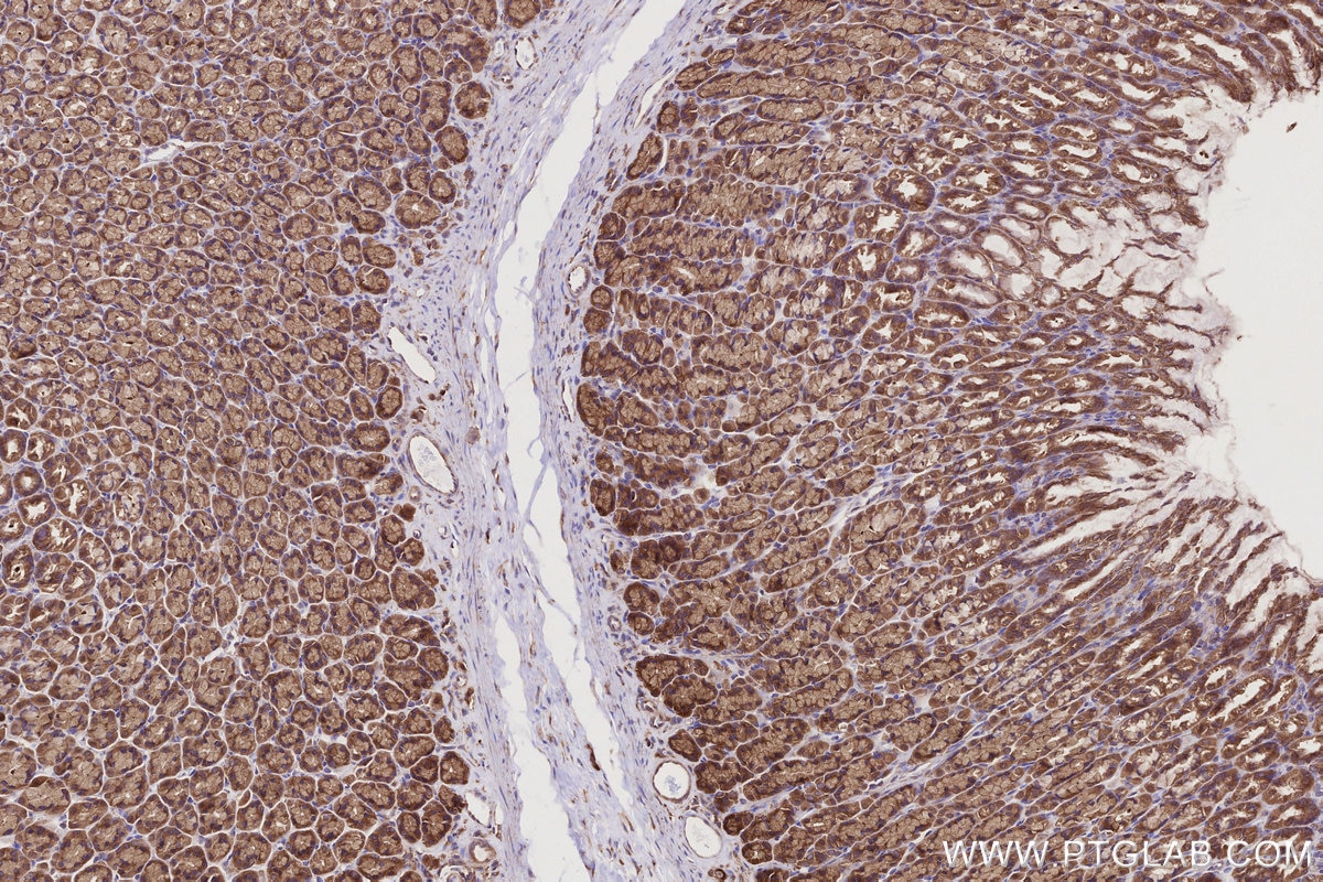 Immunohistochemistry (IHC) staining of rat stomach tissue using USP9X Polyclonal antibody (55054-1-AP)