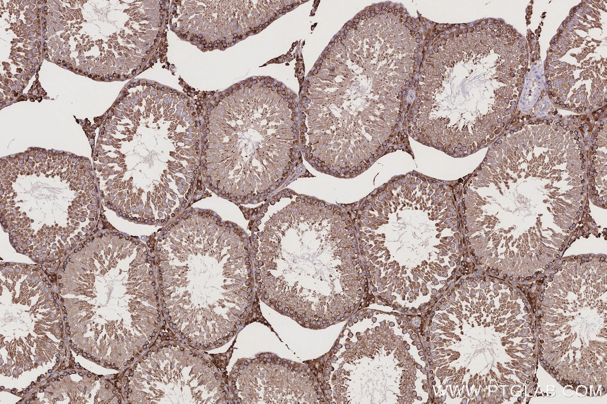 Immunohistochemical analysis of paraffin-embedded rat testis tissue slide using 55054-1-AP (USP9X antibody) at dilution of 1:1000 (under 10x lens). Heat mediated antigen retrieval with Tris-EDTA buffer (pH 9.0). Immunohistochemistry (IHC) staining of rat testis tissue using USP9X Polyclonal antibody (55054-1-AP)