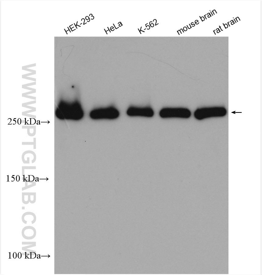Western Blot (WB) analysis of various lysates using USP9X Polyclonal antibody (55054-1-AP)