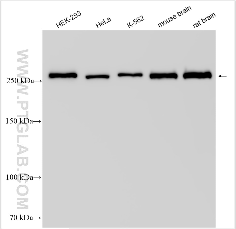 Western Blot (WB) analysis of various lysates using USP9X Polyclonal antibody (55054-1-AP)