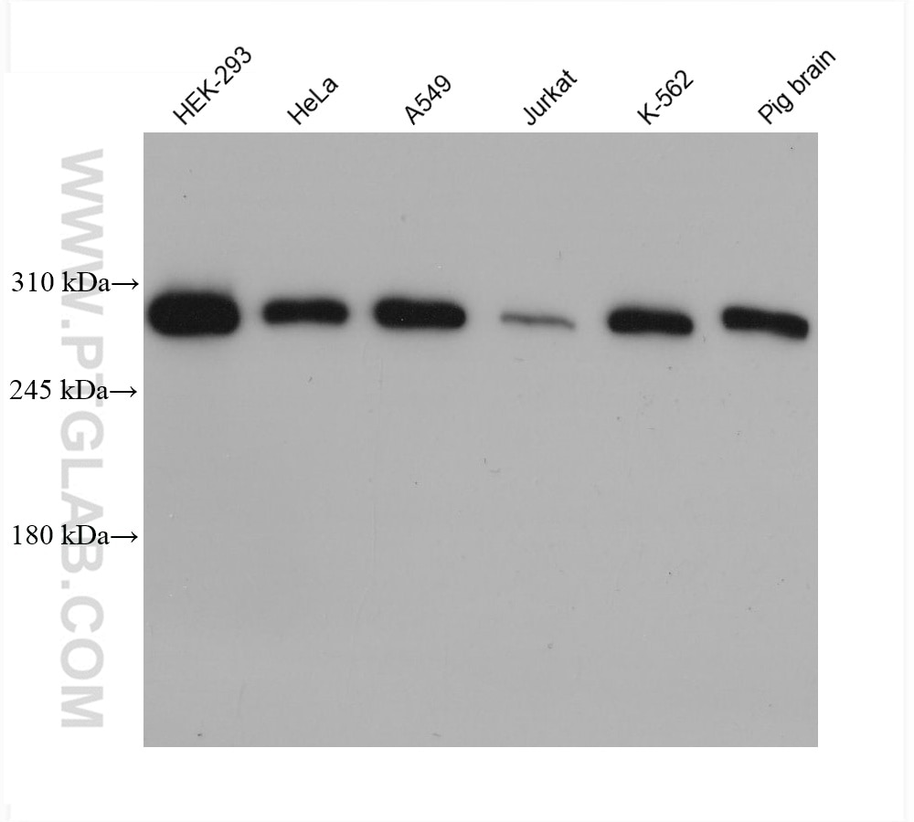 Western Blot (WB) analysis of various lysates using USP9X Monoclonal antibody (68460-1-Ig)