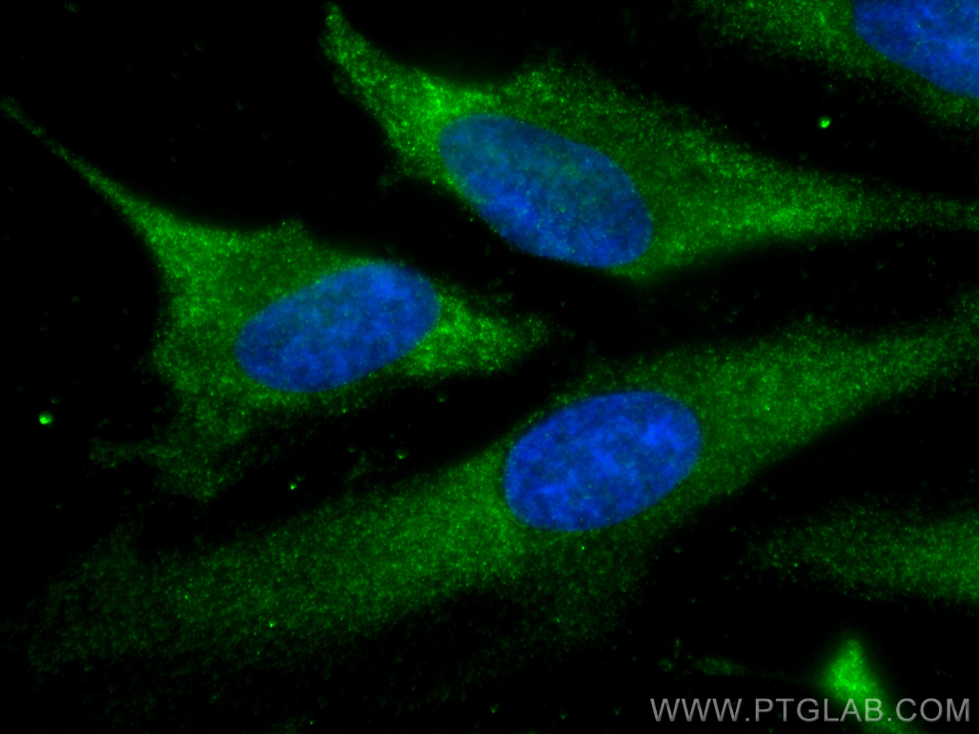 Immunofluorescence (IF) / fluorescent staining of HeLa cells using USP9X Recombinant antibody (81892-1-RR)