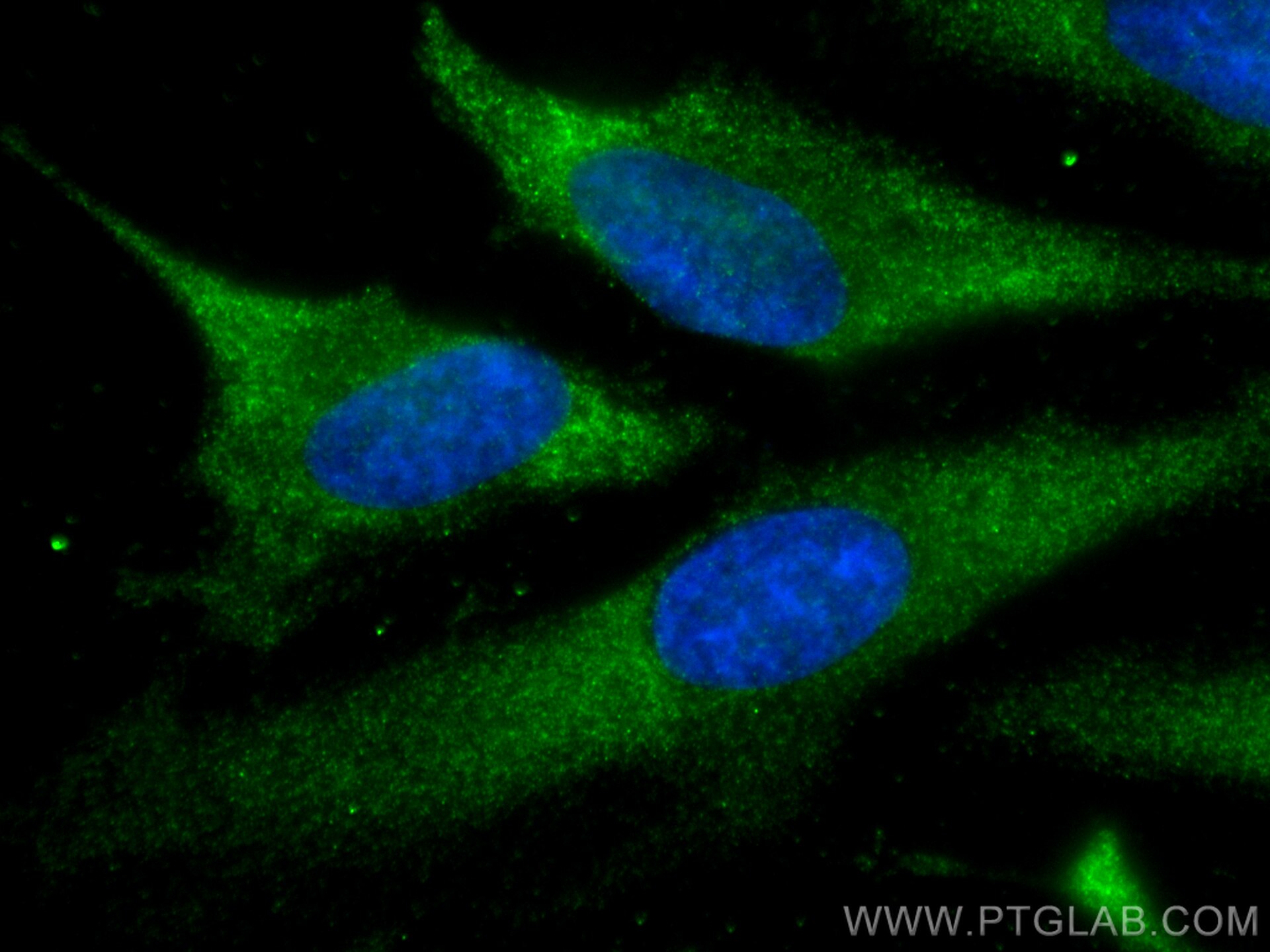 IF Staining of HeLa using 81892-1-RR