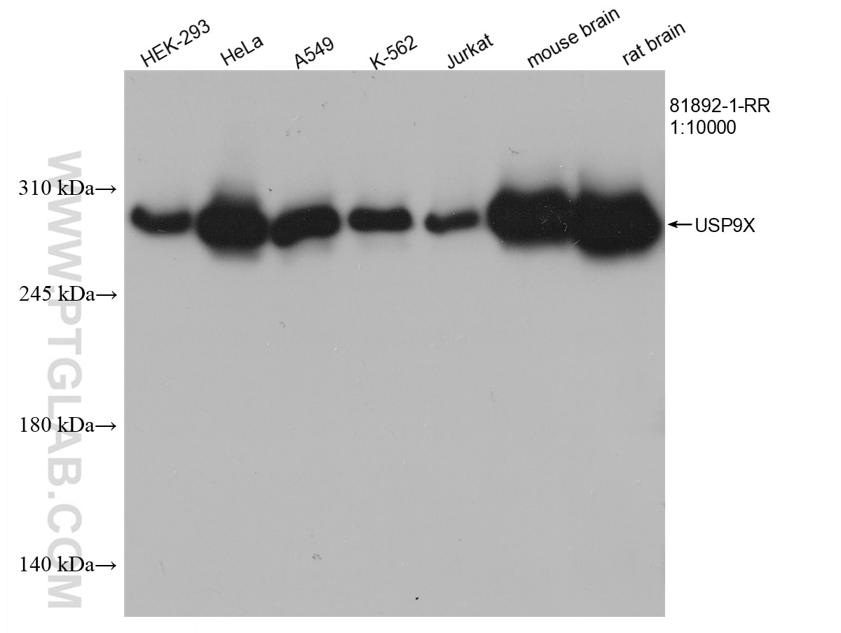 Western Blot (WB) analysis of HEK-293 cells using USP9X Recombinant antibody (81892-1-RR)