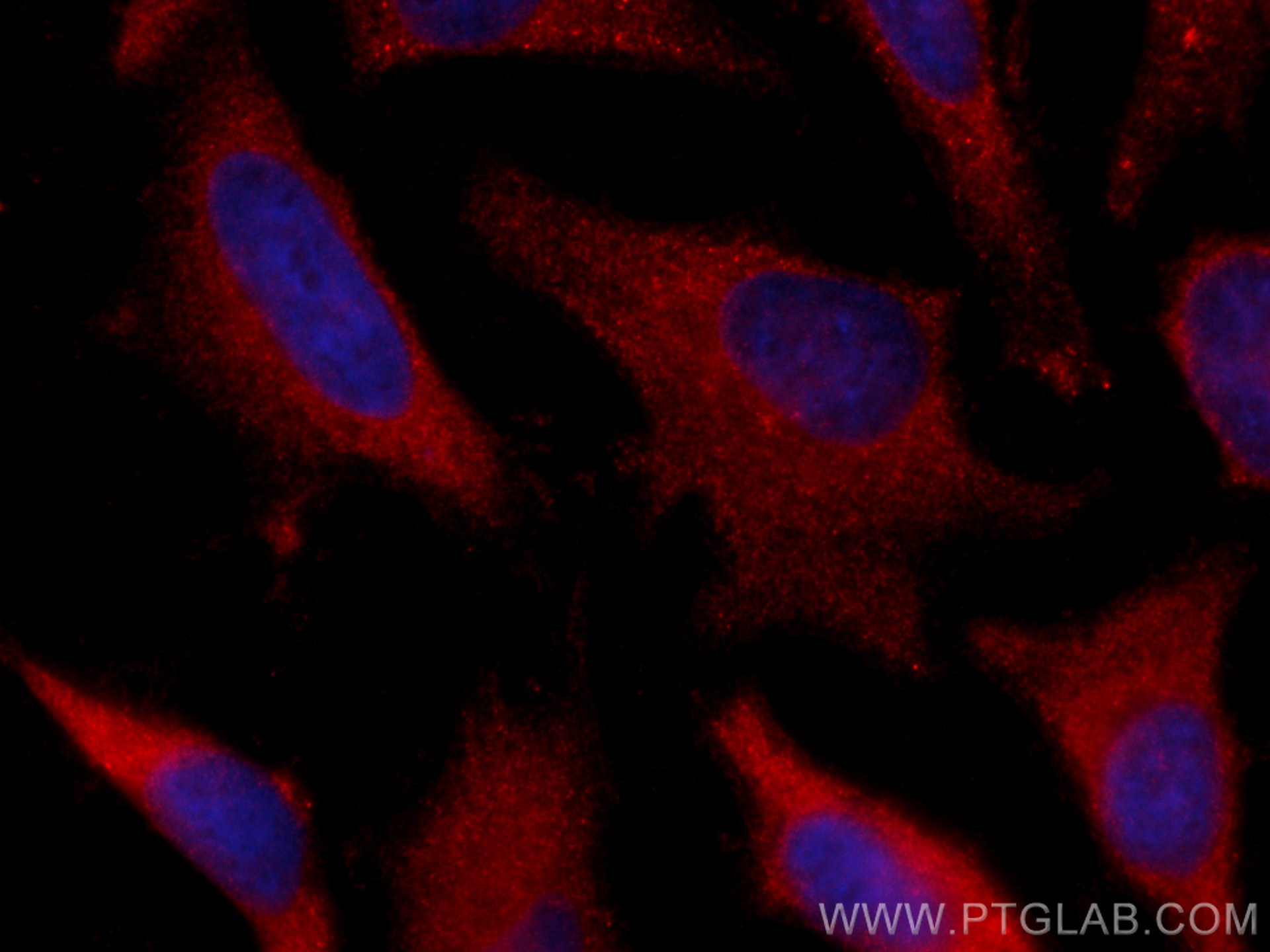 Immunofluorescence (IF) / fluorescent staining of HeLa cells using CoraLite®594-conjugated USP9X Polyclonal antibody (CL594-55054)