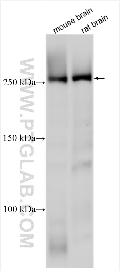 Western Blot (WB) analysis of various lysates using USP9Y Polyclonal antibody (32373-1-AP)