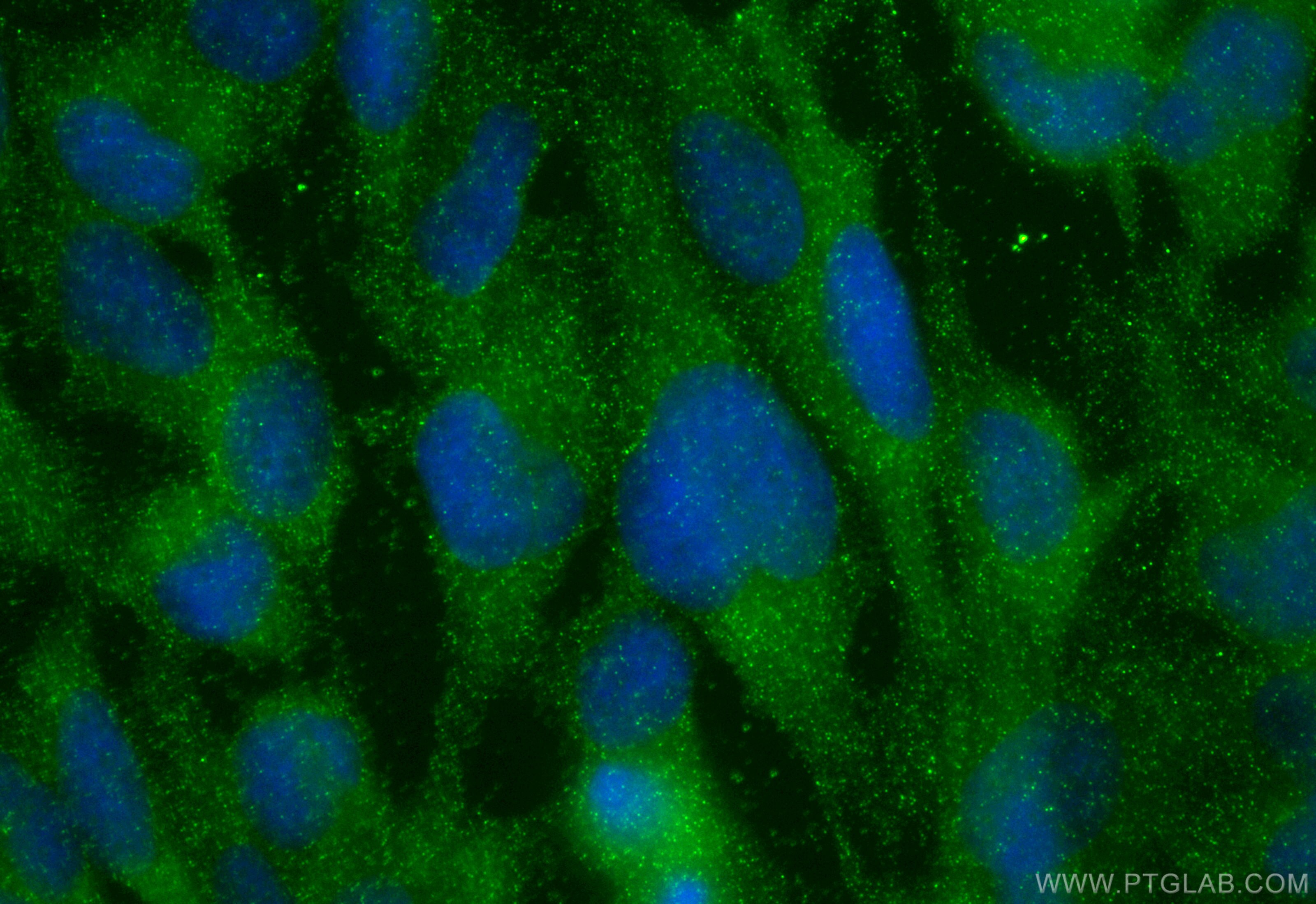 Immunofluorescence (IF) / fluorescent staining of U-251 cells using UST Polyclonal antibody (27578-1-AP)