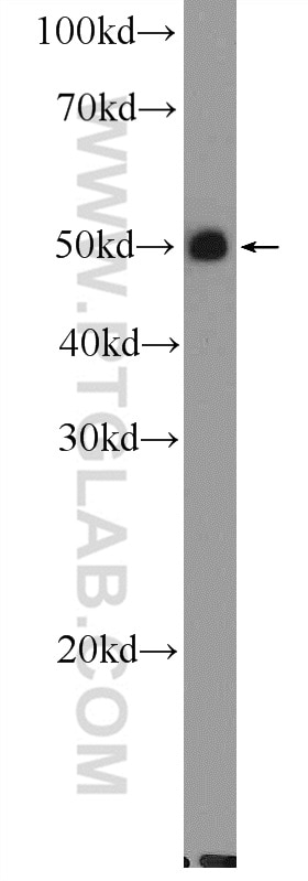 Western Blot (WB) analysis of mouse kidney tissue using UT-B Polyclonal antibody (25962-1-AP)