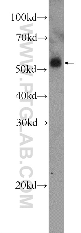 Western Blot (WB) analysis of mouse skeletal muscle tissue using UT-B Polyclonal antibody (25962-1-AP)