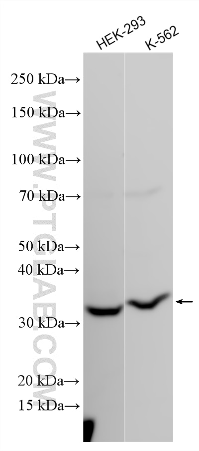Western Blot (WB) analysis of various lysates using UTP11L Polyclonal antibody (31935-1-AP)