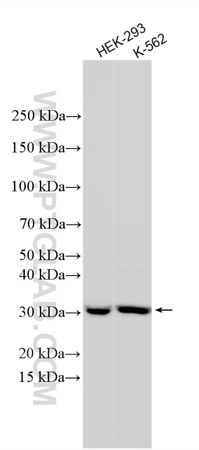 Western Blot (WB) analysis of various lysates using UTP11L Polyclonal antibody (31935-1-AP)
