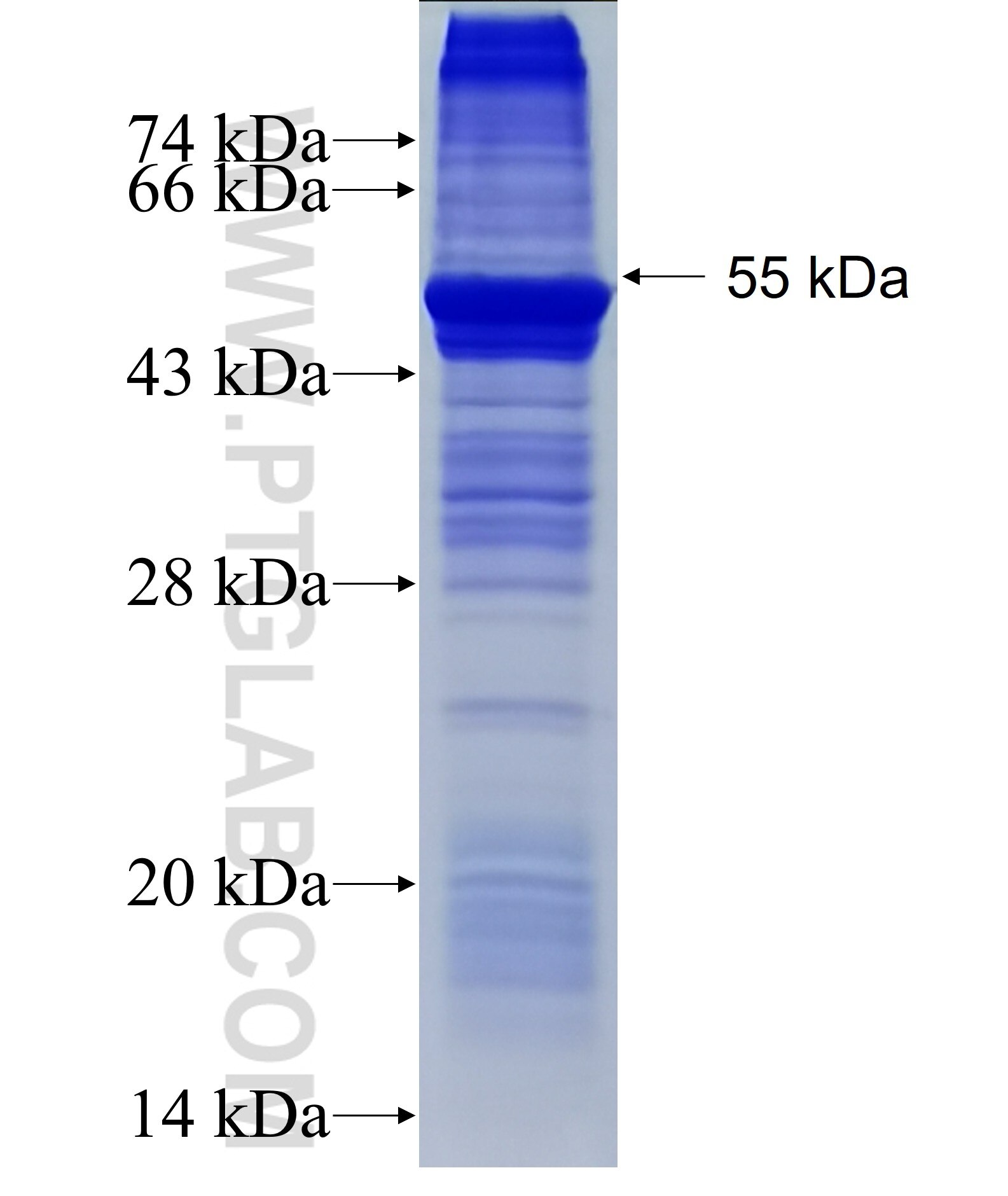 UTP11L fusion protein Ag36150 SDS-PAGE