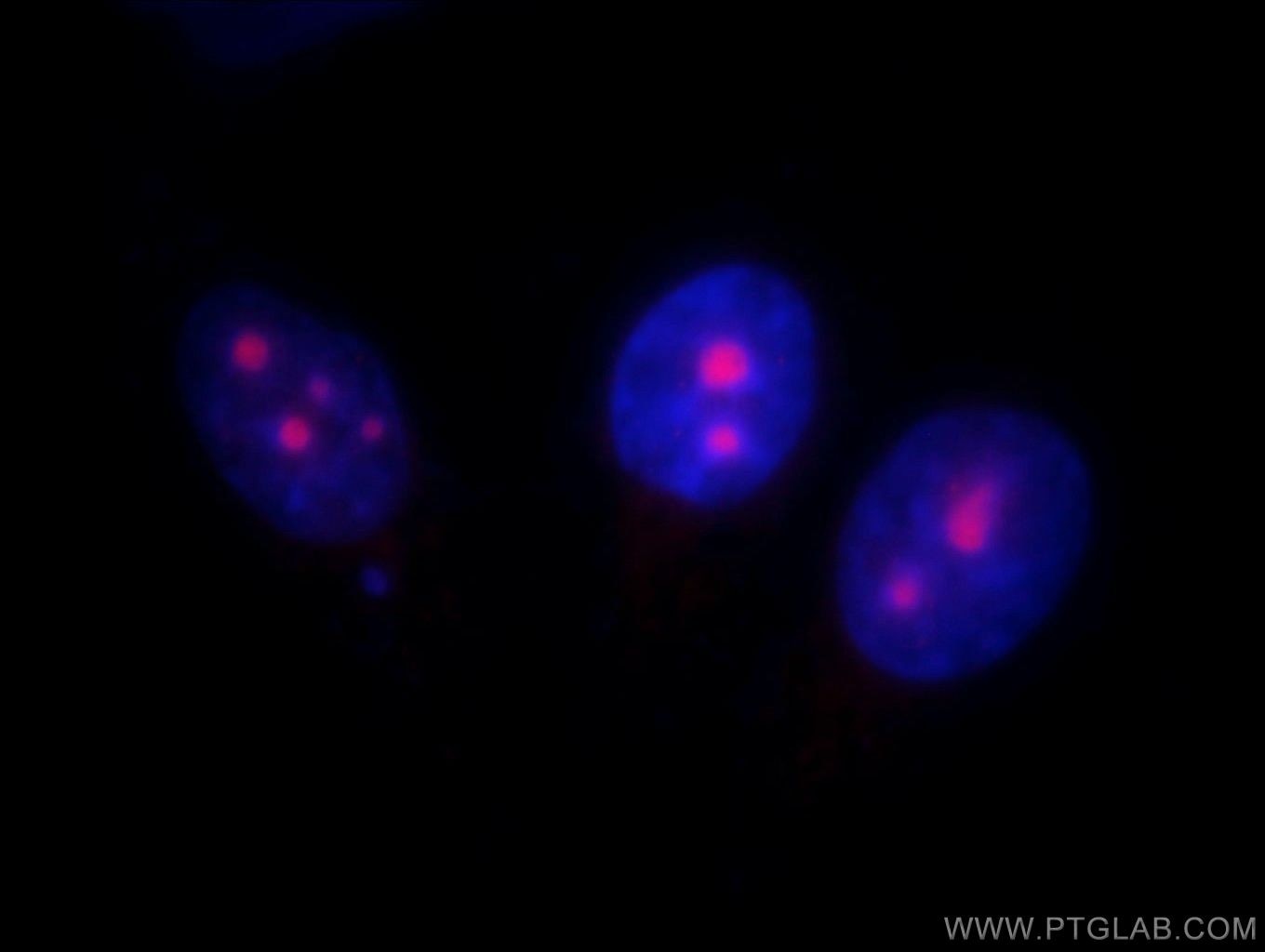 Immunofluorescence (IF) / fluorescent staining of HepG2 cells using UTP14A Polyclonal antibody (11474-1-AP)