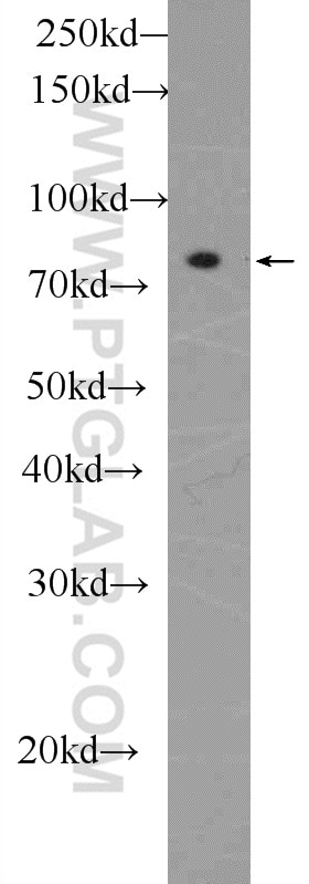 Western Blot (WB) analysis of mouse brain tissue using UTP14A Polyclonal antibody (11474-1-AP)