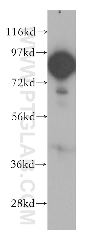 Western Blot (WB) analysis of PC-3 cells using UTP14A Polyclonal antibody (11474-1-AP)