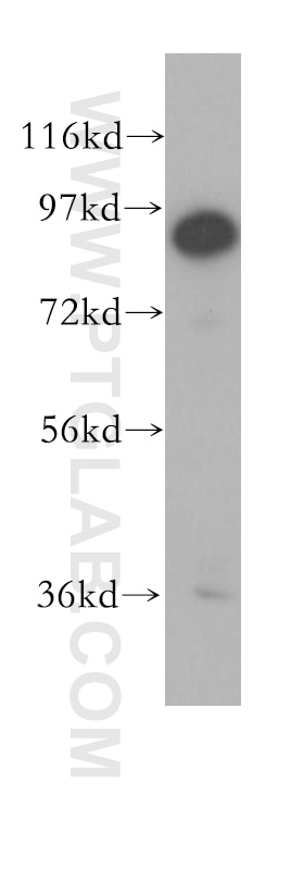 Western Blot (WB) analysis of human brain tissue using UTP14A Polyclonal antibody (11474-1-AP)