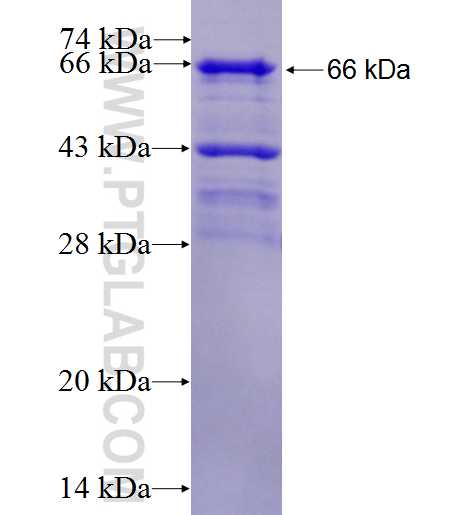 UTP14A fusion protein Ag2027 SDS-PAGE