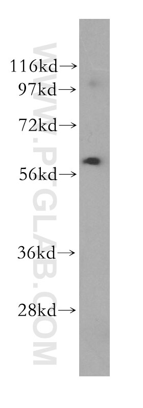 Western Blot (WB) analysis of MCF-7 cells using UTP15 Polyclonal antibody (17416-1-AP)