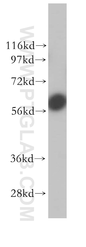 Western Blot (WB) analysis of HeLa cells using UTP15 Polyclonal antibody (17416-1-AP)