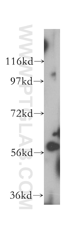 WB analysis of HeLa using 17416-1-AP