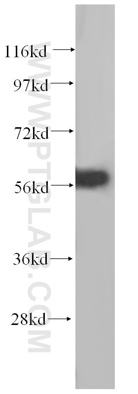 Western Blot (WB) analysis of HepG2 cells using UTP15 Polyclonal antibody (17416-1-AP)