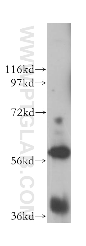 Western Blot (WB) analysis of MCF-7 cells using UTP15 Polyclonal antibody (17416-1-AP)