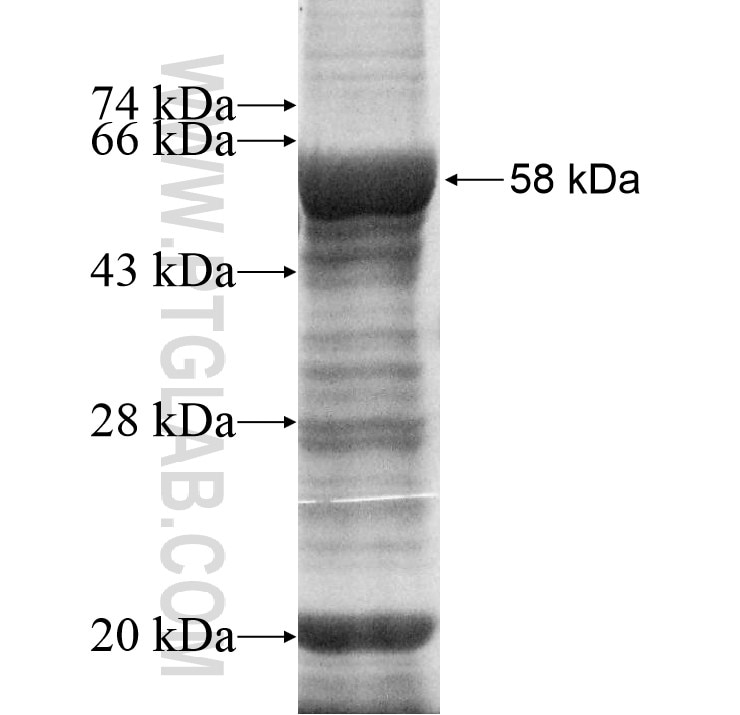 UTP15 fusion protein Ag11161 SDS-PAGE