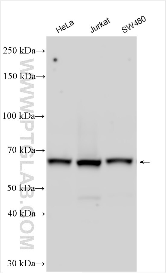 Western Blot (WB) analysis of various lysates using UTP18 Polyclonal antibody (31055-1-AP)