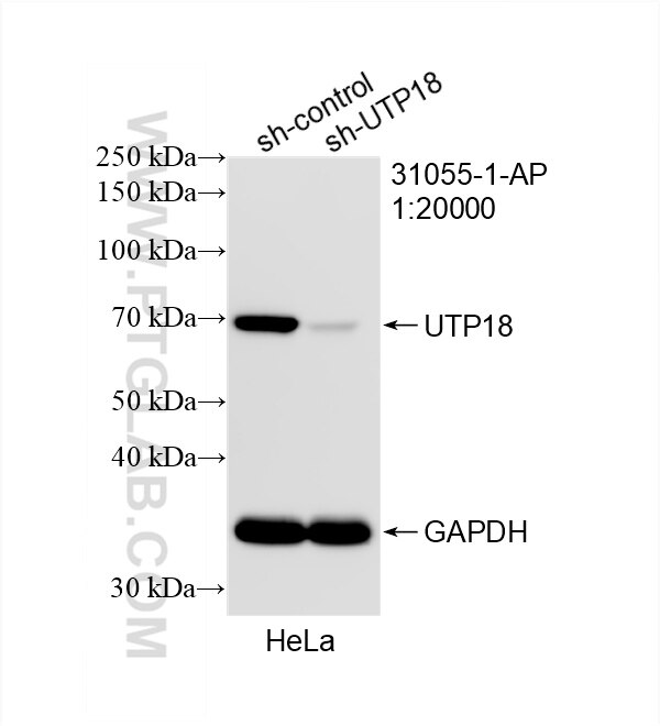 Western Blot (WB) analysis of HeLa cells using UTP18 Polyclonal antibody (31055-1-AP)