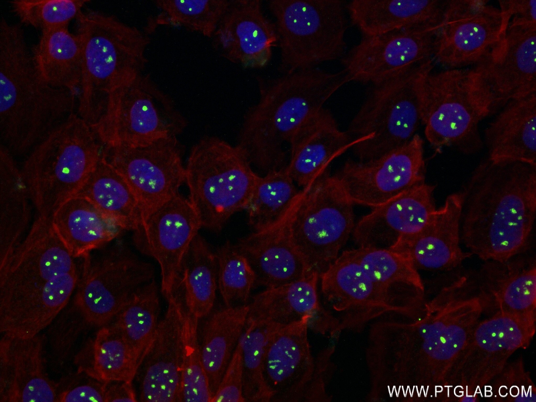 Immunofluorescence (IF) / fluorescent staining of A431 cells using UTP18 Recombinant antibody (84035-3-RR)
