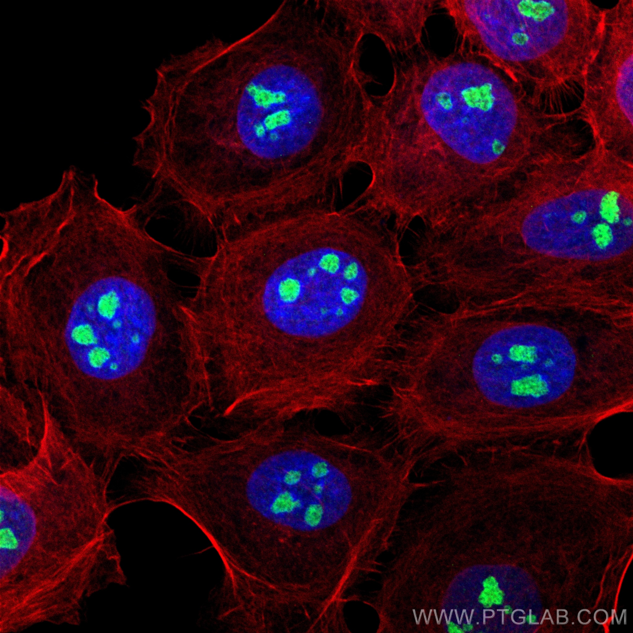Immunofluorescence (IF) / fluorescent staining of A431 cells using UTP18 Recombinant antibody (84035-3-RR)